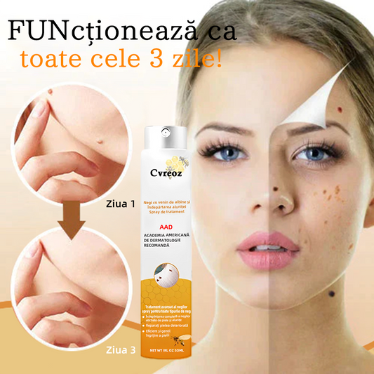 🌹💖Spray de tratament pentru îndepărtarea negilor și a etichetelor cu venin de albine Cvreoz™(👨‍⚕APDV RECOMANDĂ)🐝🐝(🔥Promoția de ultima zi 80% reducere)